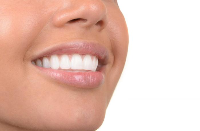 White teeth